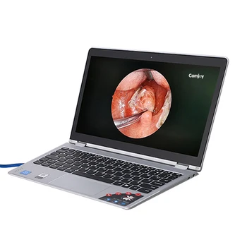Endoskopų medicinos CCD ar ENT Vandeniui medicinos USB endoskopija